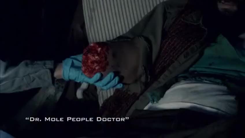 Clip of quote: Another severed arm.