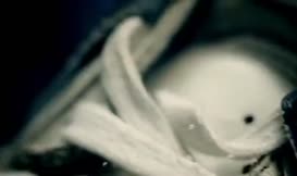 Clip of quote: where his fingers have come into contact with them, so he suffered from eczema.